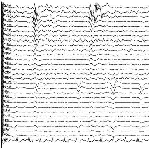 EEG Paper